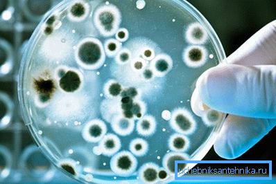 Bacteriological studies can only conduct SES Bacteriological studies can only conduct SES