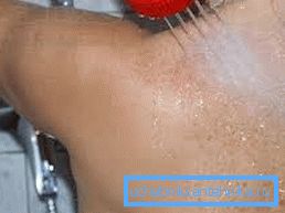 Hydromassage of the dorsal zone Hydromassage of the dorsal zone