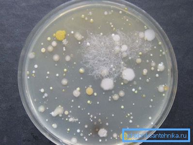 In the photo - bacteria in the water In the photo - bacteria in the water