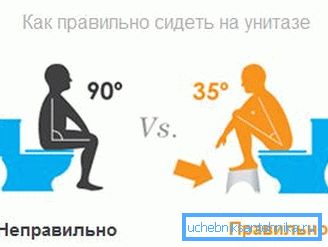In the photo - the position of a person on the toilet during defecation In the photo - the position of a person on the toilet during defecation