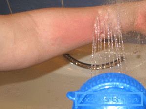 Handle treatment with hydromassage device Handle treatment with hydromassage device